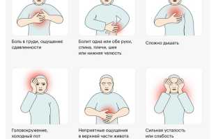 Острый коронарный синдром – что делать и как лечиться