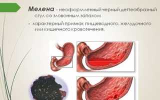 Почему появляется кровь из заднего прохода после алкоголя?