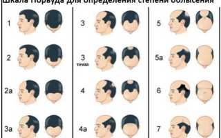 Алопеция (Облысение)