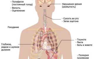Ухудшение зрения при сахарном диабете