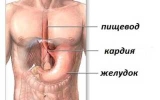 Ахалазия кардии