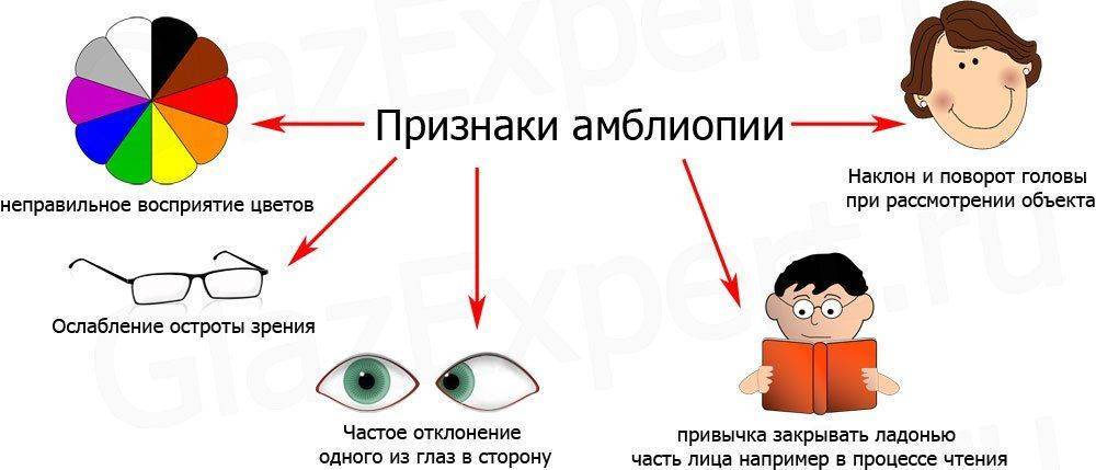 Особенности амблиопии