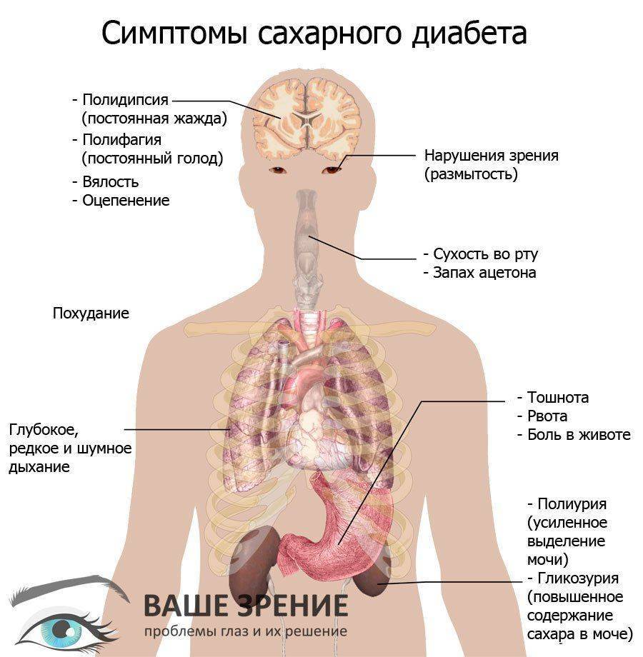 Основные симптомы сахарного диабета